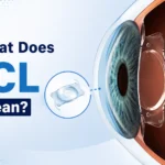 what does icl mean